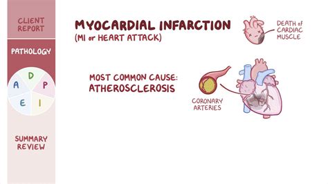 Millie - Myocardial Infarction ja Kuolema Aamupäivällä!